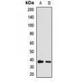 LifeSab™ HOXA11 Rabbit pAb (50 µl)