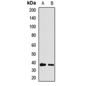 LifeSab™ HOXA11 Rabbit pAb (50 µl)