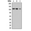 LifeSab™ ROR1 Rabbit pAb (50 µl)