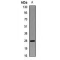 LifeSab™ CLE Rabbit pAb (50 µl)