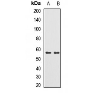 LifeSab™ TRMT2B Rabbit pAb (50 µl)