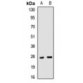 LifeSab™ Clathrin Light Chain A Rabbit pAb (50 µl)