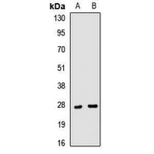 LifeSab™ Clathrin Light Chain A Rabbit pAb (50 µl)