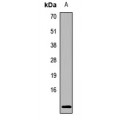 LifeSab™ Hemoglobin epsilon Rabbit pAb (50 µl)