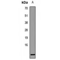 LifeSab™ SRP9 Rabbit pAb (50 µl)