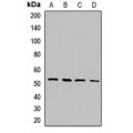 LifeSab™ MLKL Rabbit pAb (50 µl)