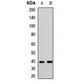 LifeSab™ FUT2 Rabbit pAb (50 µl)