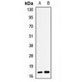 LifeSab™ TSSC3 Rabbit pAb (50 µl)