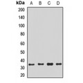 LifeSab™ NTHL1 Rabbit pAb (50 µl)