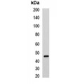 LifeSab™ Cyclin E2 Rabbit pAb (50 µl)