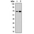 LifeSab™ TRMT2A Rabbit pAb (50 µl)