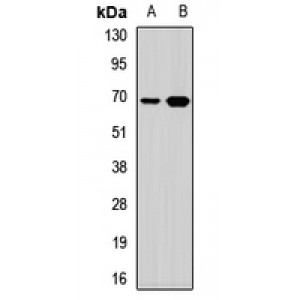 LifeSab™ TRMT2A Rabbit pAb (50 µl)