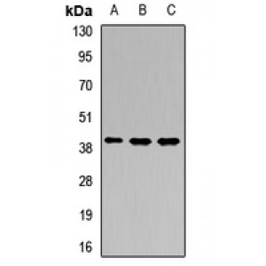 LifeSab™ PTCRA Rabbit pAb (50 µl)