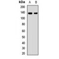 LifeSab™ AE2 Rabbit pAb (50 µl)