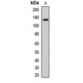 LifeSab™ PALB2 Rabbit pAb (50 µl)