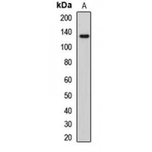 LifeSab™ PALB2 Rabbit pAb (50 µl)