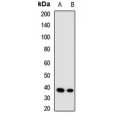 LifeSab™ ALAD Rabbit pAb (50 µl)