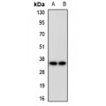 LifeSab™ Endomucin Rabbit pAb (50 µl)