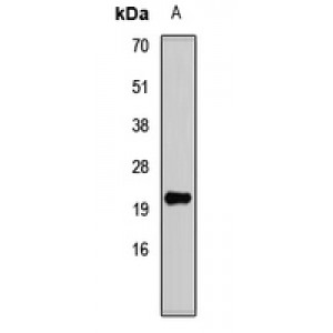 LifeSab™ DNA Polymerase delta 4 Rabbit pAb (50 µl)