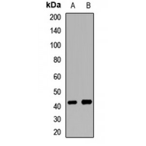 LifeSab™ RNF34 Rabbit pAb (50 µl)