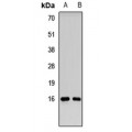 LifeSab™ RMI2 Rabbit pAb (50 µl)