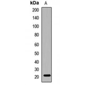 LifeSab™ CRYGC Rabbit pAb (50 µl)