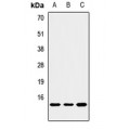 LifeSab™ NOXA Rabbit pAb (50 µl)