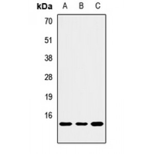 LifeSab™ NOXA Rabbit pAb (50 µl)