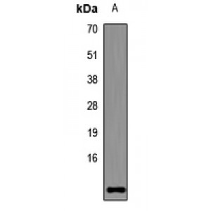 LifeSab™ STRA13 Rabbit pAb (50 µl)