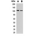 LifeSab™ MetRS Rabbit pAb (50 µl)