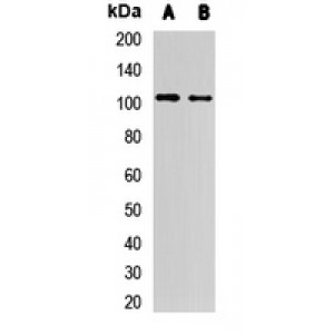 LifeSab™ MetRS Rabbit pAb (50 µl)