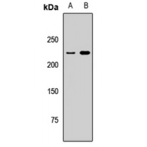 LifeSab™ TRIP12 Rabbit pAb (50 µl)