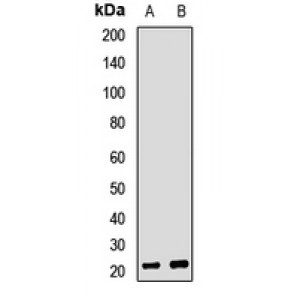 LifeSab™ RPP25 Rabbit pAb (50 µl)