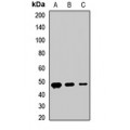 LifeSab™ CD322 Rabbit pAb (50 µl)