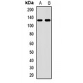 LifeSab™ FTSJ3 Rabbit pAb (50 µl)