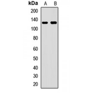 LifeSab™ FTSJ3 Rabbit pAb (50 µl)