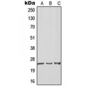 LifeSab™ ARHGDIG Rabbit pAb (50 µl)