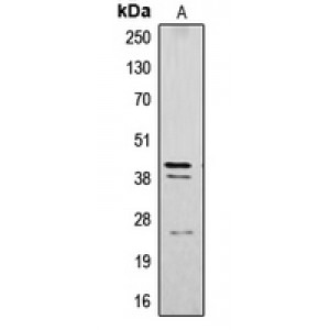 LifeSab™ CTSB Rabbit pAb (50 µl)