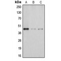 LifeSab™ DHPS Rabbit pAb (50 µl)