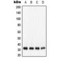 LifeSab™ NQO1 Rabbit pAb (50 µl)