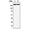 LifeSab™ Factor VIII Rabbit pAb (50 µl)