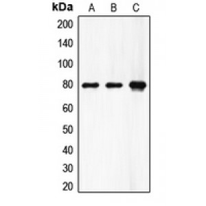 LifeSab™ Factor XIII A Rabbit pAb (50 µl)