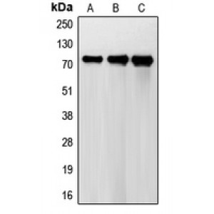 LifeSab™ FSHR Rabbit pAb (50 µl)