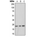 LifeSab™ GSTM1 Rabbit pAb (50 µl)