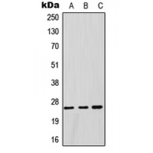 LifeSab™ GSTM1 Rabbit pAb (50 µl)