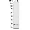 LifeSab™ IL-4 Rabbit pAb (50 µl)