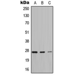 LifeSab™ ATP6 Rabbit pAb (50 µl)