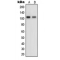 LifeSab™ OCRL Rabbit pAb (50 µl)