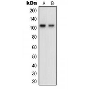 LifeSab™ OCRL Rabbit pAb (50 µl)