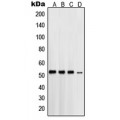 LifeSab™ Presenilin 1 Rabbit pAb (50 µl)